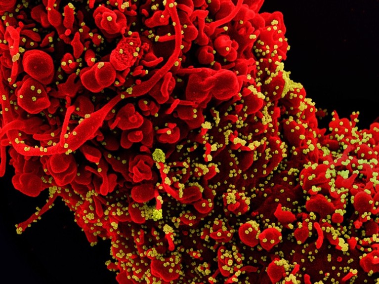 Cell infected by SARS-CoV-2 virus particles, SEM.