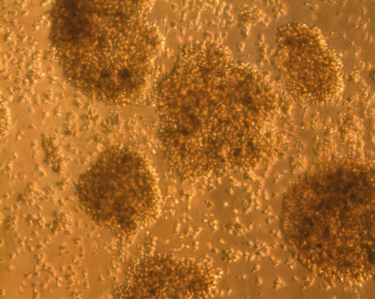 Micrograph of T cells