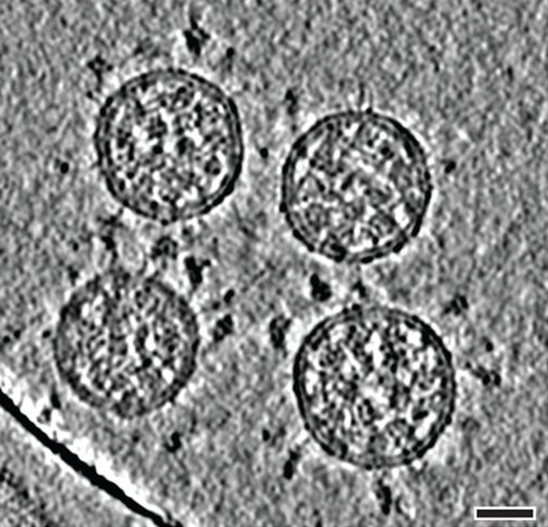 Slices through tomographic reconstructions of SARS-CoV-2 virions. Scale bars, 30 nm.