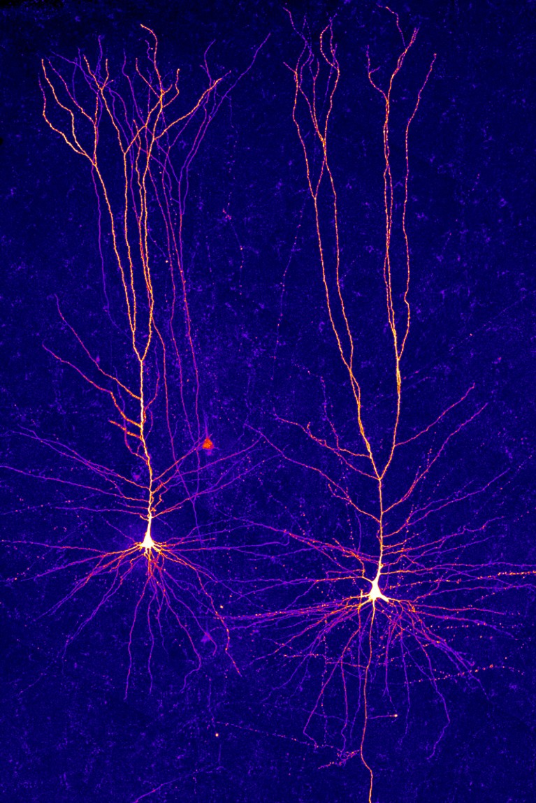 Images of neurons in a human brain highlighted in orange on a purple background