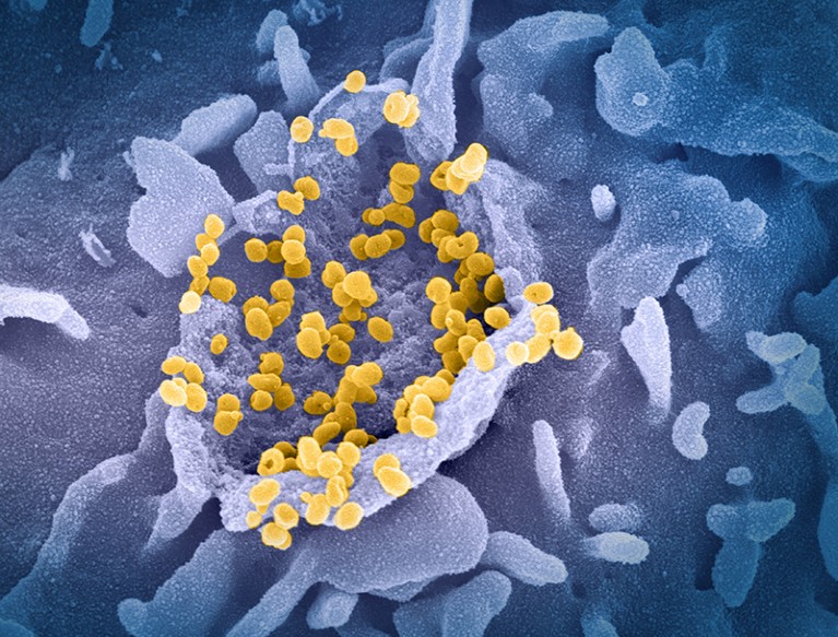 Coloured scanning electron micrograph of SARS-CoV-2 virus particles (yellow) emerging from the surface of a cell (blue).