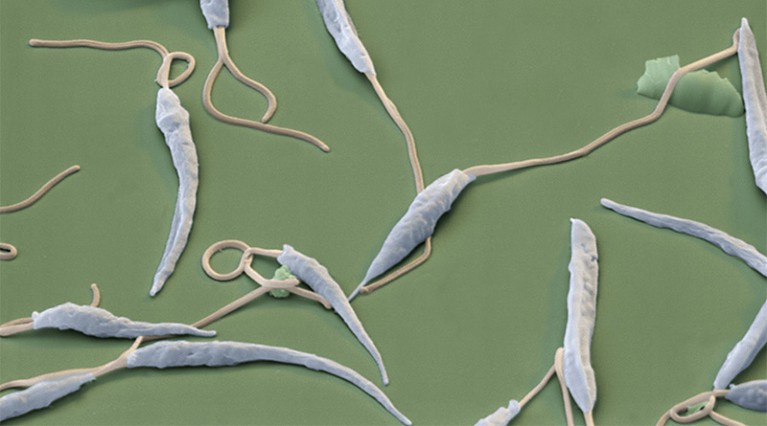 Coloured scanning electron micrograph of several Leishmania major parasitic protozoans.