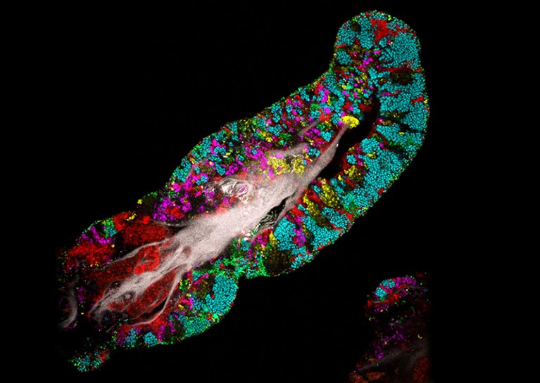 A CLASI-FISH image detailing biofilm consortia (denoted by coloured dots) on the surface of a tongue
