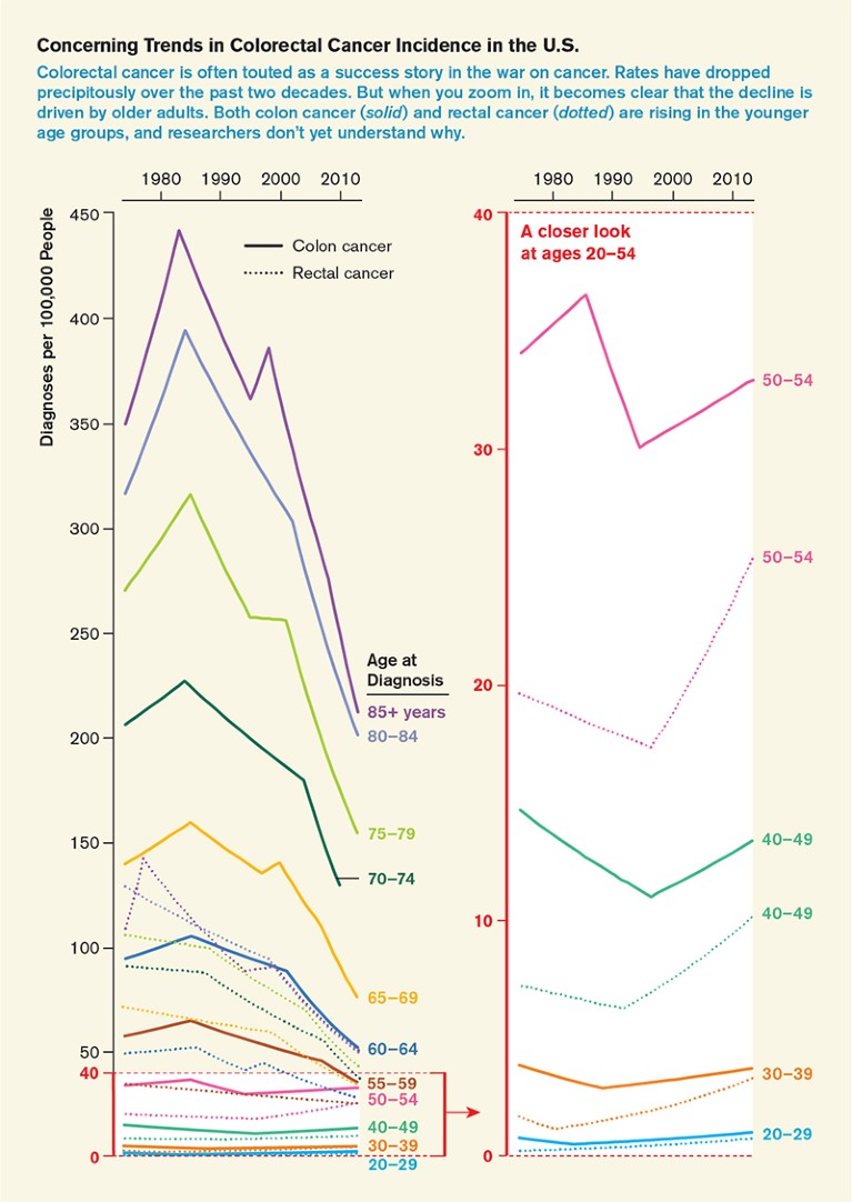 Line chart showing rates of colorectal cancer diagnosis by age group in the US over the past two decades