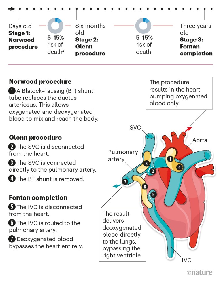 Graphic illustrating the three surgical procedures for SVDs