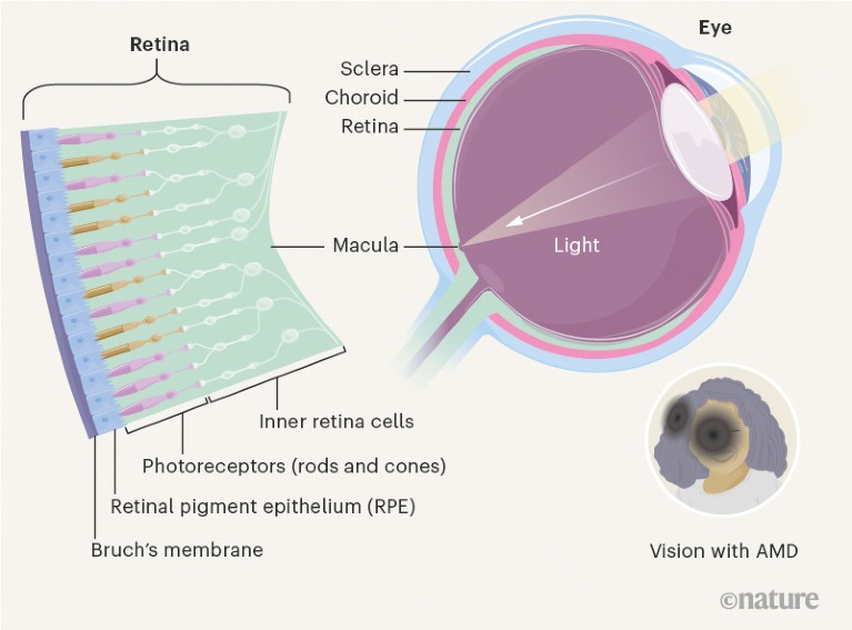 Graphic showing basic anatomy of the eye and the retina
