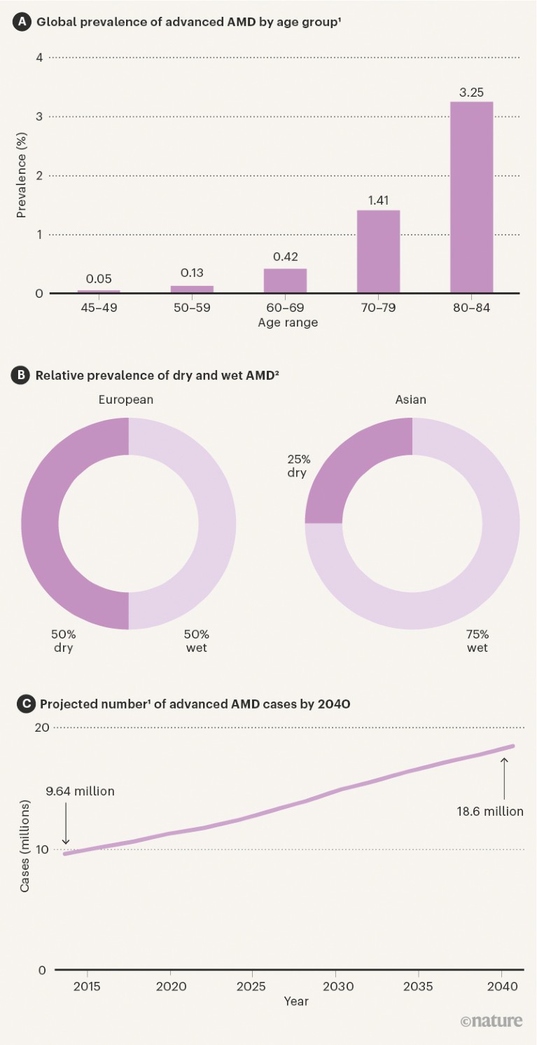 Three charts showing prevalence, rates and treatment availability for AMD