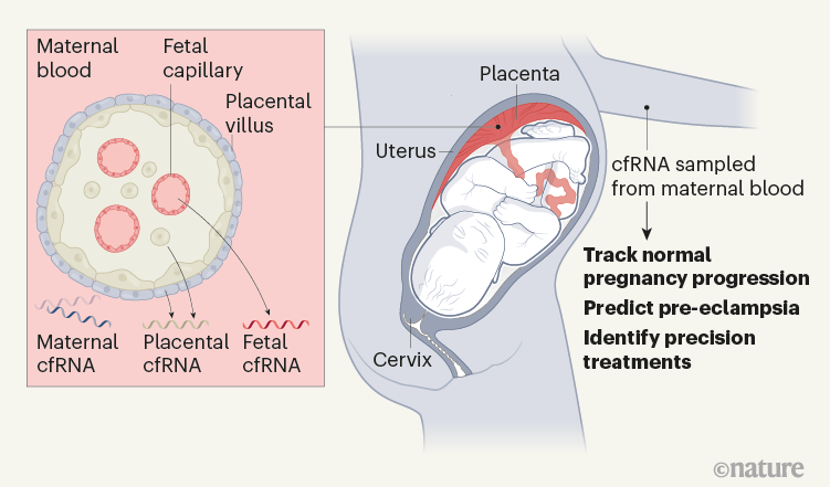 a-blood-test-to-predict-complications-of-pregnancy