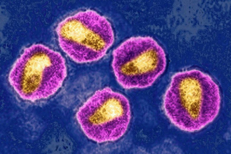 HIV virus