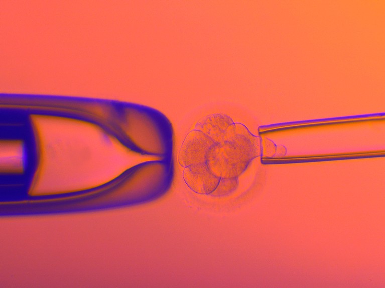 Coloured light micrograph of an IVF human embryo during pre-implantation genetic testing.