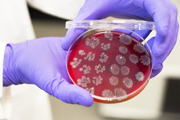Researcher's gloved hand holding a petri dish culture, part of the faecal microbiota transplantation (FMT) process