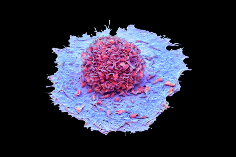 Coloured scanning electron micrograph of a macrophage white blood cell