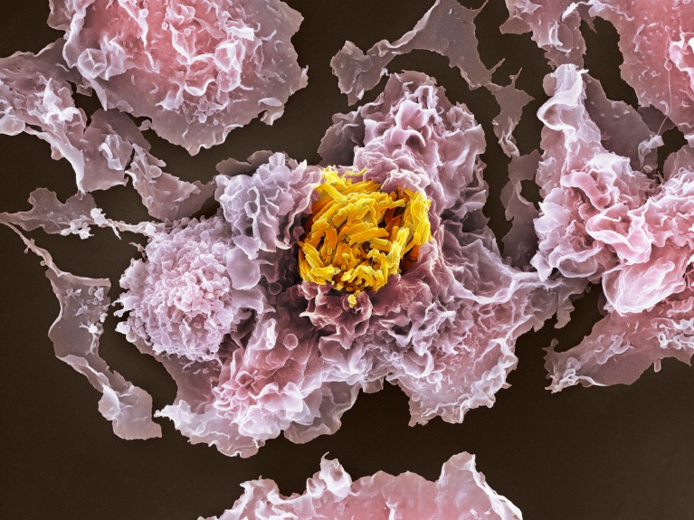 Coloured scanning electron micrograph of tuberculosis bacteria invading white blood cells
