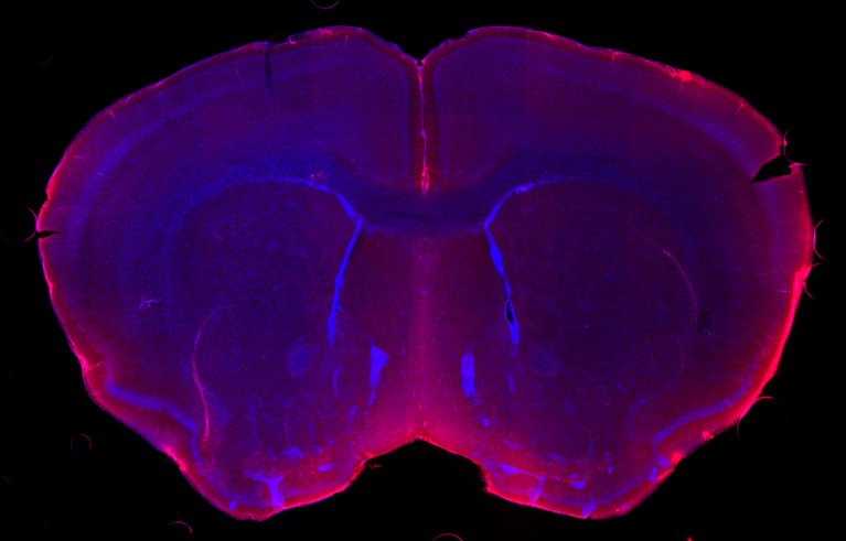 A micrograph of a mouse brain showing cerebrospinal fluid in red penetrating the brain parenchyma in blue
