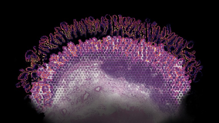 Super-resolved spatial transcriptomics of a human ileum