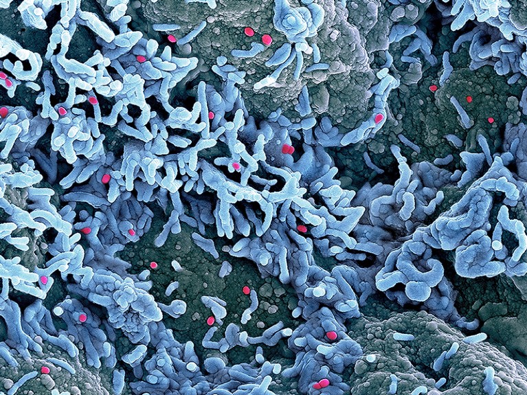 Coloured scanning electron micrograph of monkeypox virus particles on the surface of infected cells.