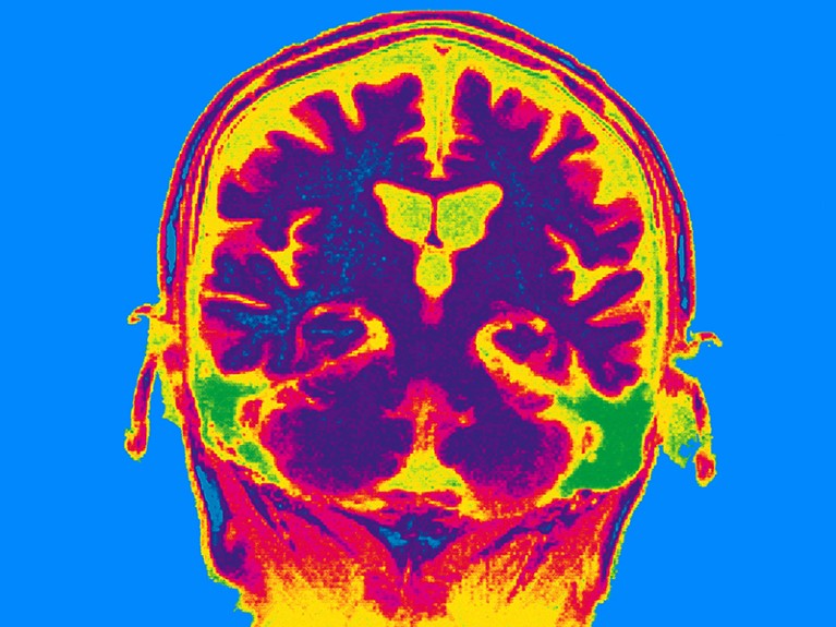 人脑横切面的扫描图，颜色鲜艳。