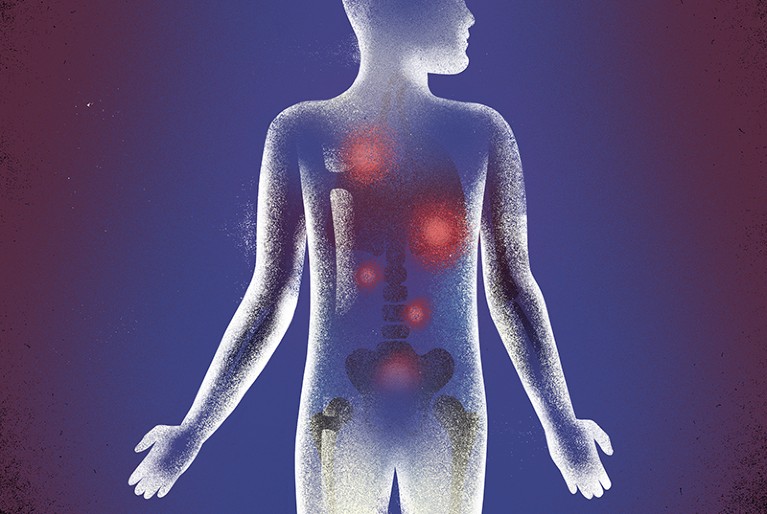 Can Prostate Cancer Spread Into Bones