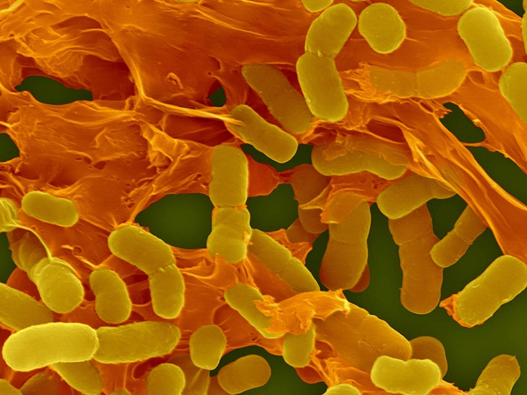 Coloured SEM of Acinetobacter baumanii bacteria