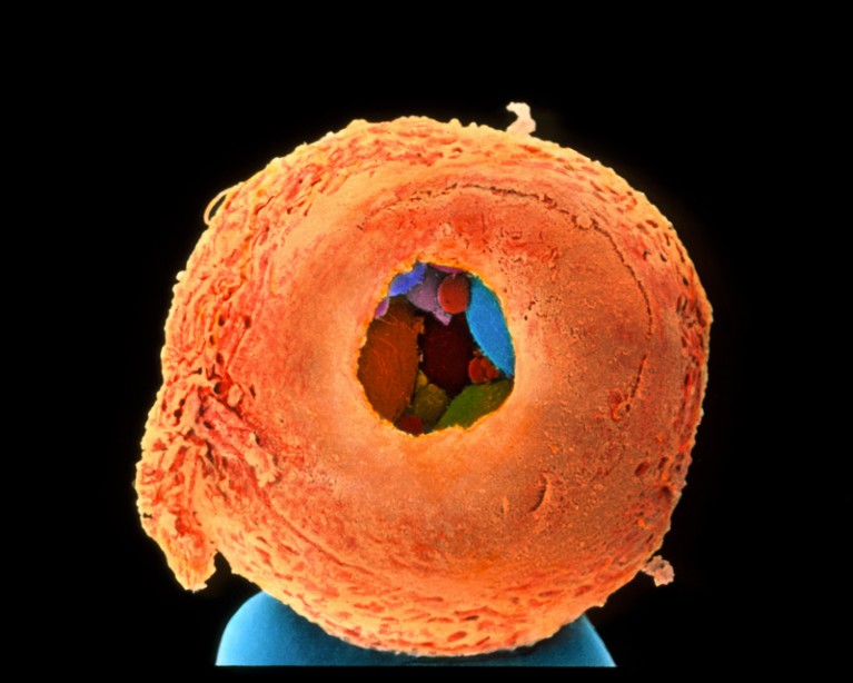 Scanning electron micrograph of an eight-cell embryo with a hole drilled in its outer membrane through which cells are visible