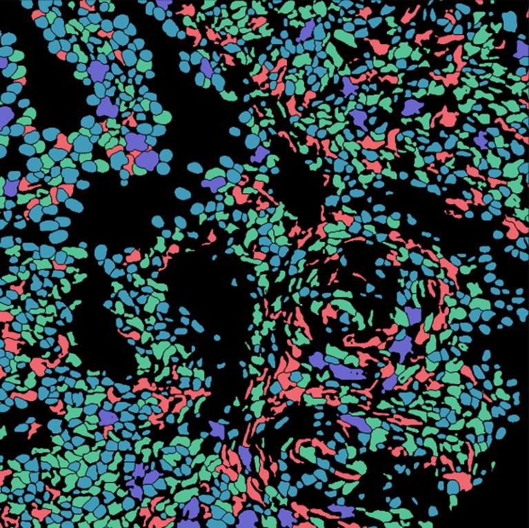 Human maternal decidua tissue with different cells labelled in different colours, as determined by artificial intelligence
