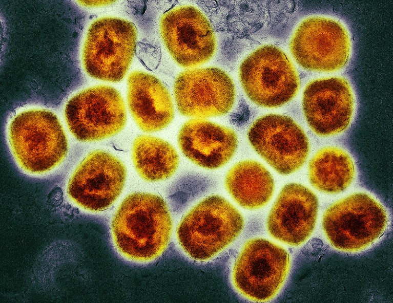 Color transmission electron micrograph (TEM) of monkeypox virus particles.