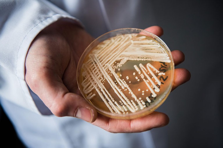 Close up of a hand holding a petri dish of the yeast candida auris.