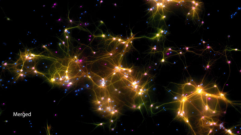 Gif animé de 4 micrographies de neurones Dishbrain avec des marqueurs fluorescents de couleurs différentes.