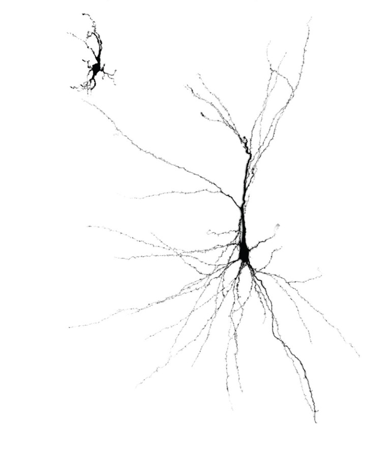 A small human neuron grown in a dish next to a large neuron grown in a rat brain