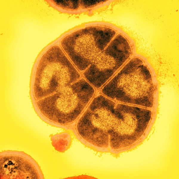 Coloured scanning electron micrograph (SEM) of four Deinococcus radiodurans bacteria forming a tetrad.
