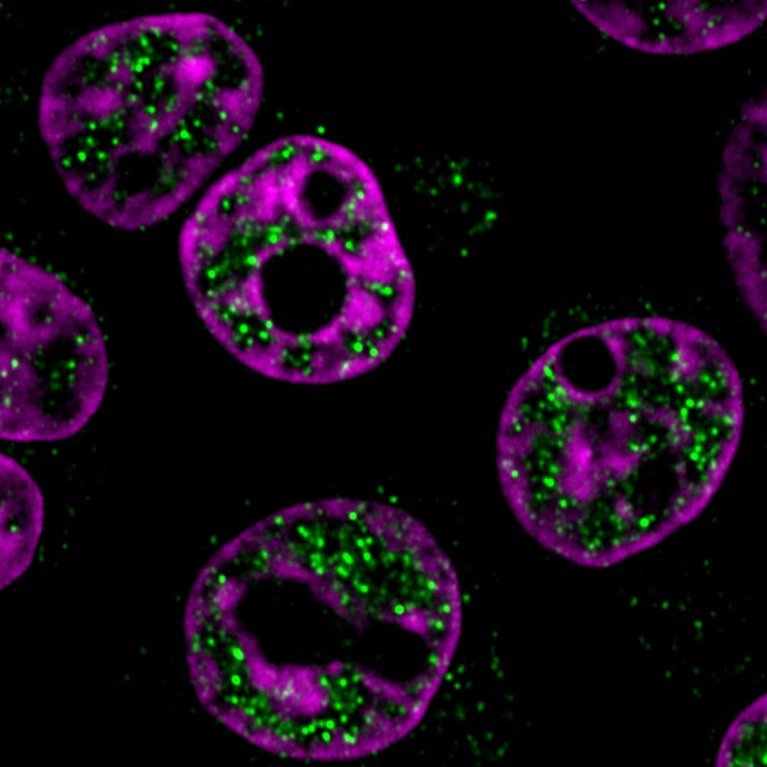 Cancer cell nuclei with MYC condensates.