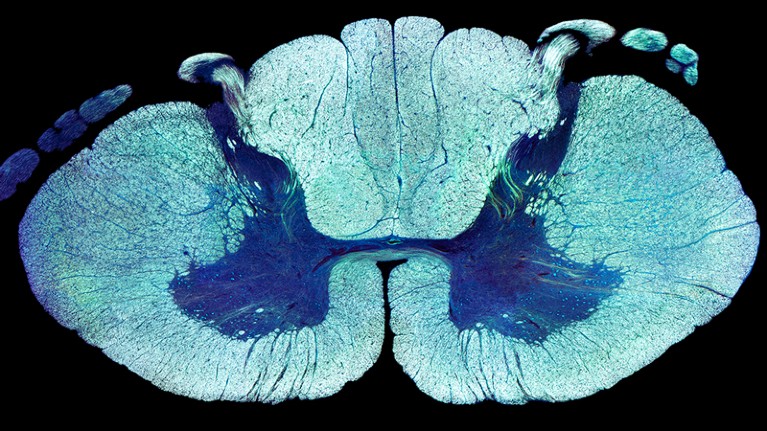 Electrical Stimulation for Spinal Cord Injury: How It Works