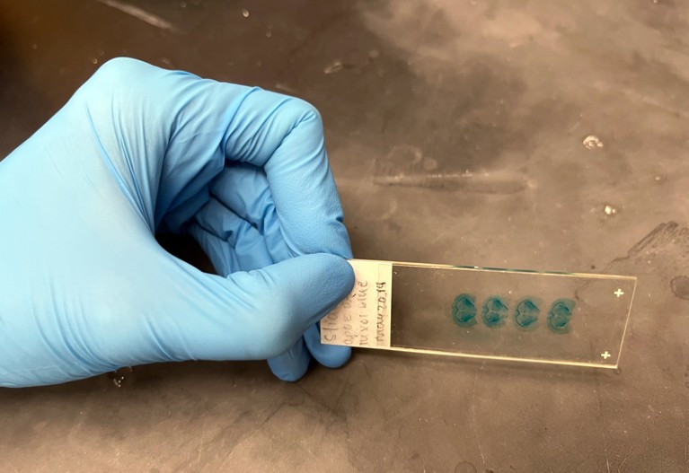 Una mano in un guanto blu che tiene un vetrino da microscopio che mostra quattro macchie blu.