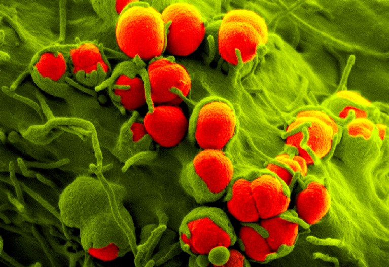 Coloured scanning electron micrograph (SEM) of Gonorrhoea bacteria.