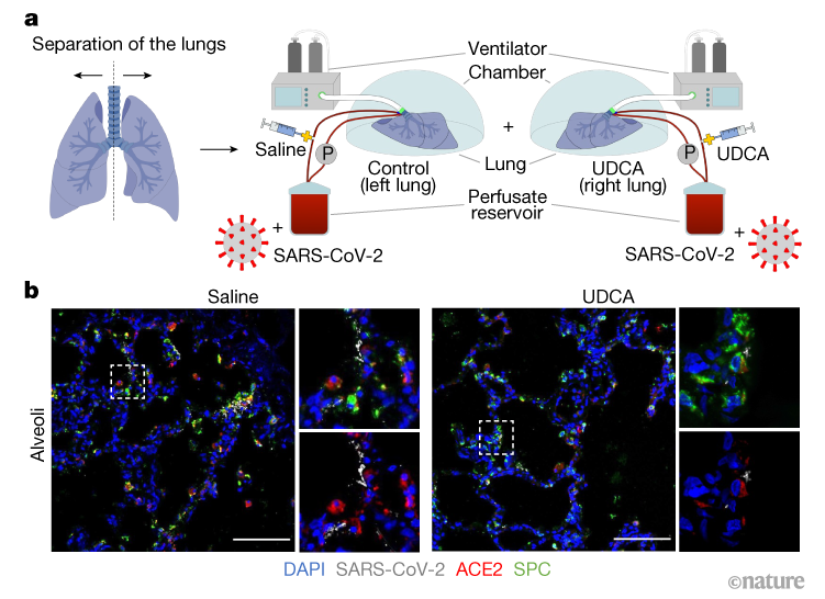 A Liver Drug Reduces SARS CoV Entry Into Cells