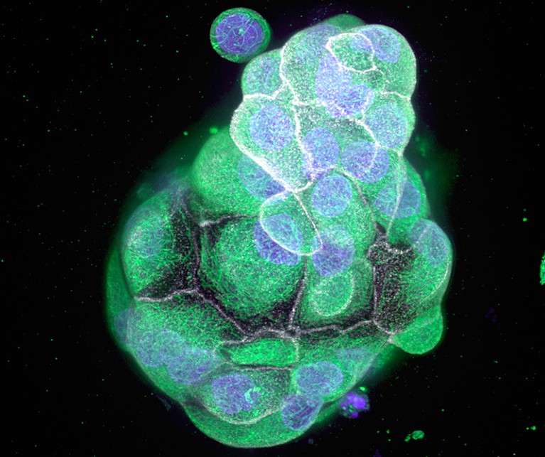 Micrograph of a colon cancer organoid culture