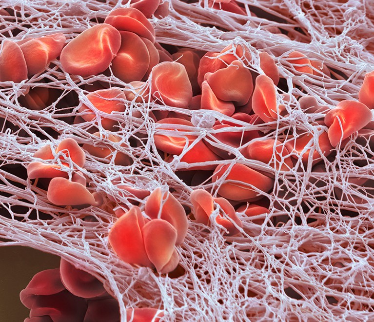 Red blood cells with fibrin