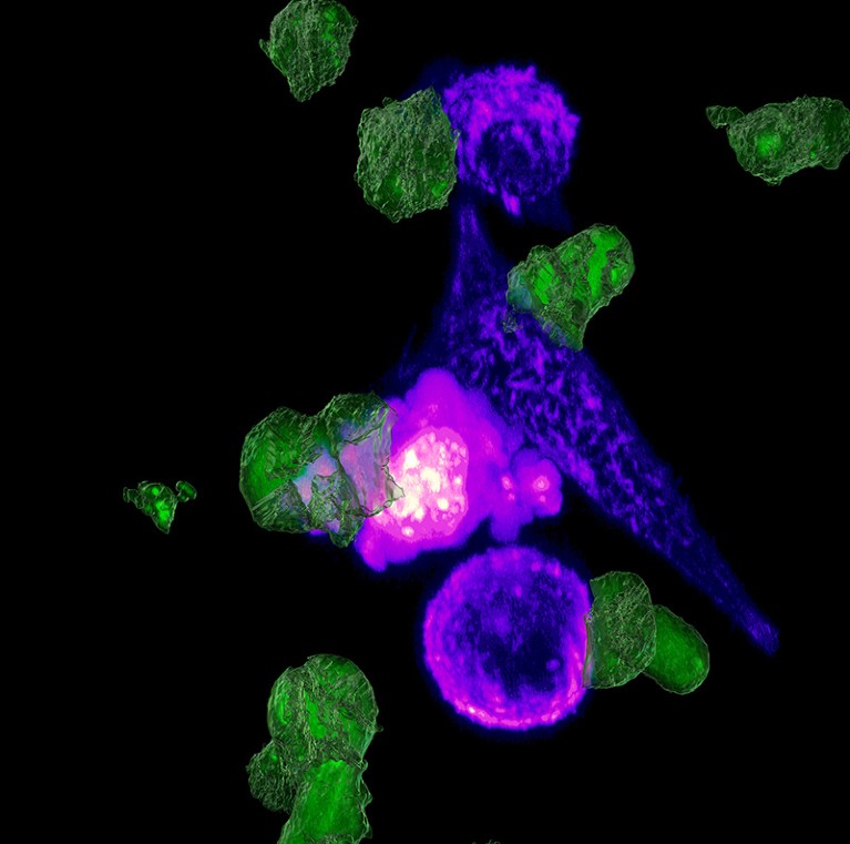 Micrograph of CAR-T cells and tumour cells