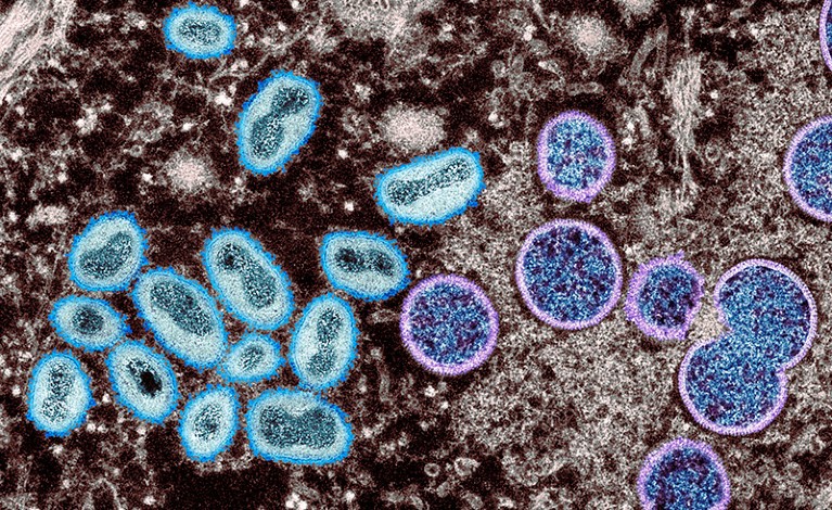 Coloured transmission electron micrograph (TEM) showing monkeypox virus particles from a human skin sample