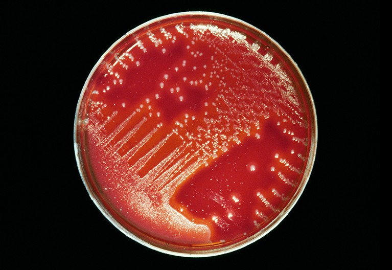 Colonies of Streptococcus pyogenes, a Gram-positive bacterium, growing on blood agar in a petri dish.