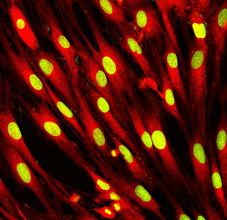 Fibroblasts (skin cells) labelled with fluorescent dyes.