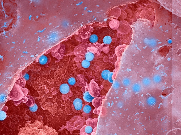 Micrografia eletrônica de varredura colorida (SEM) de vírus influenza (gripe) (azul) brotando de uma célula epitelial estourada.