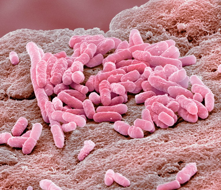 Colored scanning electron micrograph of the rod-shaped, gram-negative bacterium Escherichia coli
