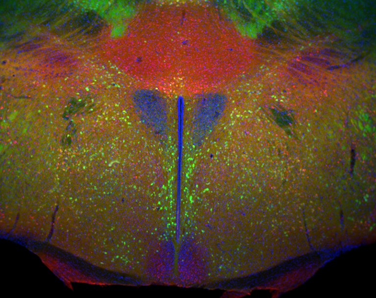 An SEM of the hypothalamus from a D2-eGFP (green) transgenic mouse stained for calretinin (red) and DAPI to show nuclei.