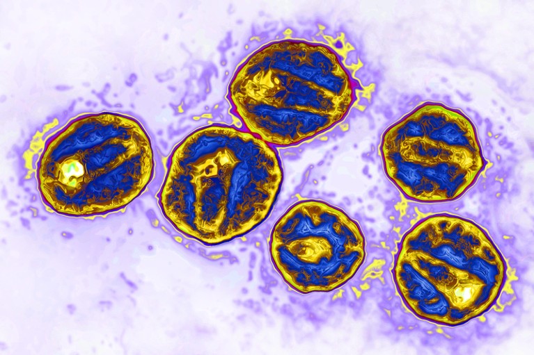 Enhanced transmission electron micrograph of the HIV virus