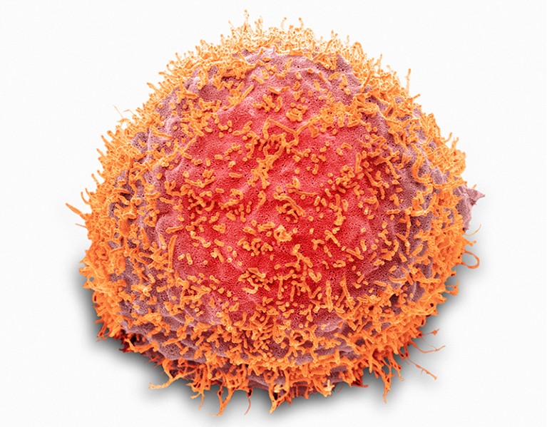 感染乙型流感病毒的人体细胞的彩色扫描电子显微照片。