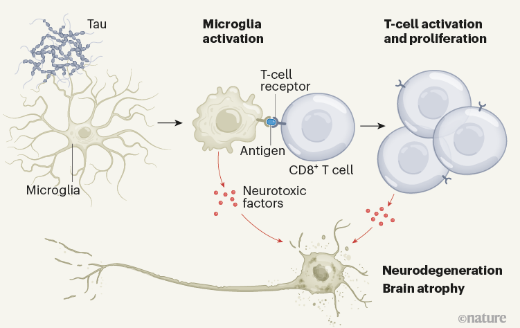 Activated Immune Cells Drive Neurodegeneration In An Alzheimer’s Model