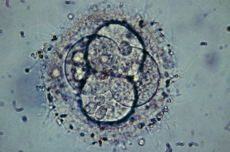 Light micrograph of a human embryo composed of four cells