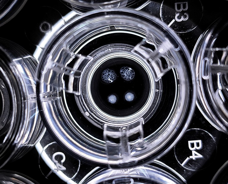 Close-up of organoids being grown in a well