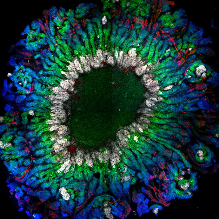 A close-up image of an organoid